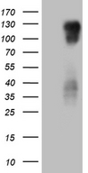 PODXL2 / Endoglycan Antibody - HEK293T cells were transfected with the pCMV6-ENTRY control. (Left lane) or pCMV6-ENTRY PODXL2. (Right lane) cDNA for 48 hrs and lysed. Equivalent amounts of cell lysates. (5 ug per lane) were separated by SDS-PAGE and immunoblotted with anti-PODXL2. (1:2000)