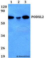 PODXL2 / Endoglycan Antibody - Western blot of PODXL2 antibody at 1:500 dilution. Lane 1: HEK293T whole cell lysate. Lane 2: Raw264.7 whole cell lysate. Lane 3: H9C2 whole cell lysate.