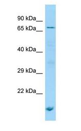 POF1B Antibody - POF1B antibody Western Blot of Jurkat.  This image was taken for the unconjugated form of this product. Other forms have not been tested.