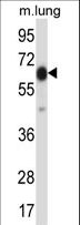 POF1B Antibody - POF1B Antibody western blot of mouse lung tissue lysates (35 ug/lane). The POF1B antibody detected the POF1B protein (arrow).