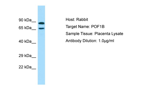 POF1B Antibody -  This image was taken for the unconjugated form of this product. Other forms have not been tested.