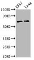 POF1B Antibody - Western Blot Positive WB detected in: K562 whole cell lysate, Rat lung tissue All Lanes: POF1B antibody at 3.4µg/ml Secondary Goat polyclonal to rabbit IgG at 1/50000 dilution Predicted band size: 69, 35 KDa Observed band size: 69 KDa