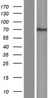POF1B Protein - Western validation with an anti-DDK antibody * L: Control HEK293 lysate R: Over-expression lysate