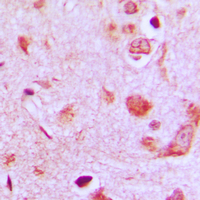 POFUT1 Antibody - Immunohistochemical analysis of POFUT1 staining in human brain formalin fixed paraffin embedded tissue section. The section was pre-treated using heat mediated antigen retrieval with sodium citrate buffer (pH 6.0). The section was then incubated with the antibody at room temperature and detected using an HRP conjugated compact polymer system. DAB was used as the chromogen. The section was then counterstained with hematoxylin and mounted with DPX.