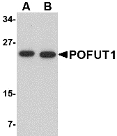 POFUT1 Antibody - Western blot of POFUT1 in human heart tissue lysate with POFUT1 antibody at (A) 0.5 and (B) 1 ug/ml.