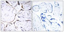 POFUT2 Antibody - Immunohistochemistry analysis of paraffin-embedded human placenta tissue, using POFUT2 Antibody. The picture on the right is blocked with the synthesized peptide.