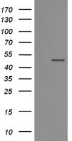 POFUT2 Antibody - HEK293T cells were transfected with the pCMV6-ENTRY control (Left lane) or pCMV6-ENTRY POFUT2 (Right lane) cDNA for 48 hrs and lysed. Equivalent amounts of cell lysates (5 ug per lane) were separated by SDS-PAGE and immunoblotted with anti-POFUT2.