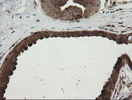 POGK Antibody - IHC of paraffin-embedded Human breast tissue using anti-POGK mouse monoclonal antibody.