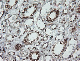 POGK Antibody - IHC of paraffin-embedded Human Kidney tissue using anti-POGK mouse monoclonal antibody.