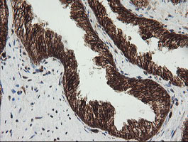 POGK Antibody - IHC of paraffin-embedded Human prostate tissue using anti-POGK mouse monoclonal antibody.