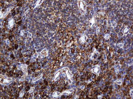 POGK Antibody - IHC of paraffin-embedded Human lymph node tissue using anti-POGK mouse monoclonal antibody.