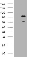POGK Antibody - HEK293T cells were transfected with the pCMV6-ENTRY control (Left lane) or pCMV6-ENTRY POGK (Right lane) cDNA for 48 hrs and lysed. Equivalent amounts of cell lysates (5 ug per lane) were separated by SDS-PAGE and immunoblotted with anti-POGK.