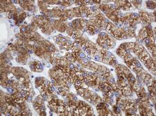 POGK Antibody - IHC of paraffin-embedded Human liver tissue using anti-POGK mouse monoclonal antibody.