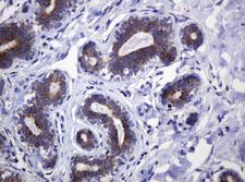 POGK Antibody - IHC of paraffin-embedded Human breast tissue using anti-POGK mouse monoclonal antibody.