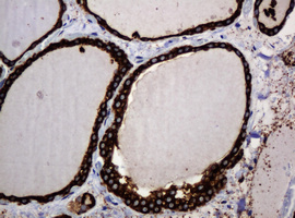 POGK Antibody - IHC of paraffin-embedded Human thyroid tissue using anti-POGK mouse monoclonal antibody.