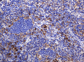 POGK Antibody - IHC of paraffin-embedded Human lymph node tissue using anti-POGK mouse monoclonal antibody.
