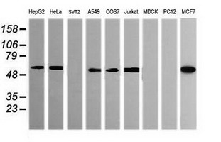 POGK Antibody - Western blot of extracts (35 ug) from 9 different cell lines by using g anti-POGK monoclonal antibody (HepG2: human; HeLa: human; SVT2: mouse; A549: human; COS7: monkey; Jurkat: human; MDCK: canine; PC12: rat; MCF7: human).