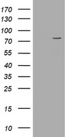 POGK Antibody - HEK293T cells were transfected with the pCMV6-ENTRY control (Left lane) or pCMV6-ENTRY POGK (Right lane) cDNA for 48 hrs and lysed. Equivalent amounts of cell lysates (5 ug per lane) were separated by SDS-PAGE and immunoblotted with anti-POGK.