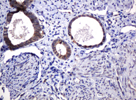 POGK Antibody - IHC of paraffin-embedded Human endometrium tissue using anti-POGK mouse monoclonal antibody.