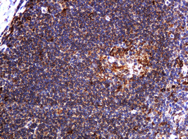 POGK Antibody - IHC of paraffin-embedded Human lymph node tissue using anti-POGK mouse monoclonal antibody.