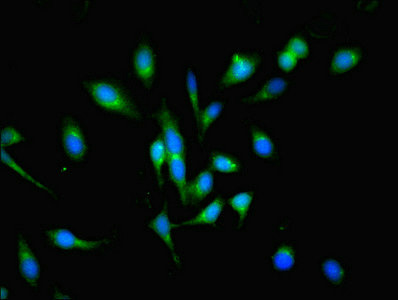 POGK Antibody - Immunofluorescent analysis of Hela cells using POGK Antibody at dilution of 1:100 and Alexa Fluor 488-congugated AffiniPure Goat Anti-Rabbit IgG(H+L)