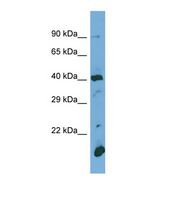 POGLUT1 Antibody - Western blot of Human Jurkat. POGLUT1 antibody dilution 1.0 ug/ml.  This image was taken for the unconjugated form of this product. Other forms have not been tested.