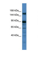 POGZ Antibody - POGZ antibody Western blot of 1 Cell lysate. Antibody concentration 1 ug/ml. This image was taken for the unconjugated form of this product. Other forms have not been tested.
