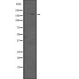 POGZ Antibody - Western blot analysis of POGZ expression in HepG2 cells lysate; SH-SY5Y cells lysate. The lane on the left is treated with the antigen-specific peptide.