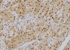 POGZ Antibody - 1:100 staining human kidney tissue by IHC-P. The sample was formaldehyde fixed and a heat mediated antigen retrieval step in citrate buffer was performed. The sample was then blocked and incubated with the antibody for 1.5 hours at 22°C. An HRP conjugated goat anti-rabbit antibody was used as the secondary.
