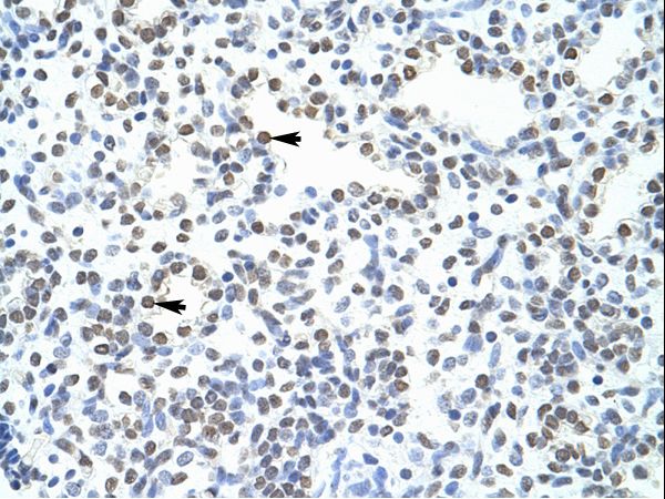 POGZ Antibody - POGZ antibody ARP39172_T100-NP_055915-POGZ (pogo transposable element with ZNF domain) Antibody was used in IHC to stain formalin-fixed, paraffin-embedded human lung.  This image was taken for the unconjugated form of this product. Other forms have not been tested.