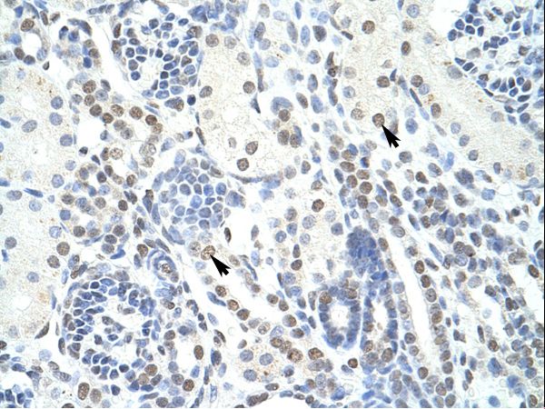 POGZ Antibody - POGZ antibody ARP39172_T100-NP_055915-POGZ (pogo transposable element with ZNF domain) Antibody was used in IHC to stain formalin-fixed, paraffin-embedded human kidney.  This image was taken for the unconjugated form of this product. Other forms have not been tested.