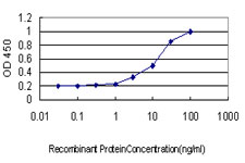 POLA1 / DNA Polymerase Alpha 1 Antibody - Detection limit for recombinant GST tagged POLA is approximately 0.3 ng/ml as a capture antibody.
