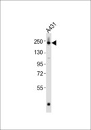 POLA1 / DNA Polymerase Alpha 1 Antibody - Anti-DNA Polymerase alpha 1 Antibody at 1:1000 dilution + A431 whole cell lysates Lysates/proteins at 20 ug per lane. Secondary Goat Anti-Rabbit IgG, (H+L),Peroxidase conjugated at 1/10000 dilution Predicted band size : 166 kDa Blocking/Dilution buffer: 5% NFDM/TBST.