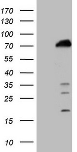 POLA2 / DNA Polymerase Alpha 2 Antibody - HEK293T cells were transfected with the pCMV6-ENTRY control. (Left lane) or pCMV6-ENTRY POLA2. (Right lane) cDNA for 48 hrs and lysed. Equivalent amounts of cell lysates. (5 ug per lane) were separated by SDS-PAGE and immunoblotted with anti-POLA2. (1:2000)