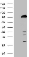 POLA2 / DNA Polymerase Alpha 2 Antibody - HEK293T cells were transfected with the pCMV6-ENTRY control (Left lane) or pCMV6-ENTRY POLA2 (Right lane) cDNA for 48 hrs and lysed. Equivalent amounts of cell lysates (5 ug per lane) were separated by SDS-PAGE and immunoblotted with anti-POLA2 (1:2000).
