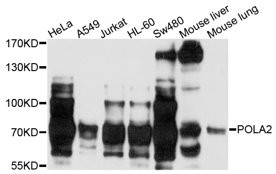 POLA2 / DNA Polymerase Alpha 2 Antibody - Western blot analysis of extracts of various cells.