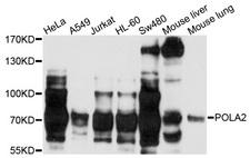 POLA2 / DNA Polymerase Alpha 2 Antibody - Western blot analysis of extracts of various cells.