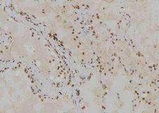POLA2 / DNA Polymerase Alpha 2 Antibody - 1:100 staining human lung tissue by IHC-P. The sample was formaldehyde fixed and a heat mediated antigen retrieval step in citrate buffer was performed. The sample was then blocked and incubated with the antibody for 1.5 hours at 22°C. An HRP conjugated goat anti-rabbit antibody was used as the secondary.