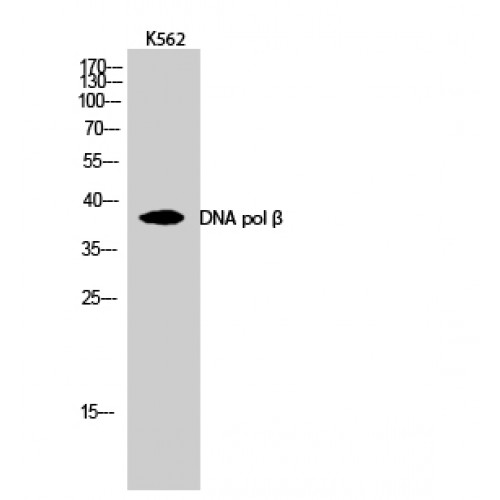 POLB / DNA Polymerase Beta Antibody - Western blot of DNA pol beta antibody