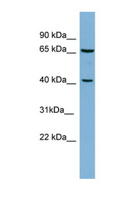 POLB / DNA Polymerase Beta Antibody - POLB / DNA Polymerase Beta antibody Western blot of HT1080 cell lysate. This image was taken for the unconjugated form of this product. Other forms have not been tested.