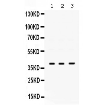 POLB / DNA Polymerase Beta Antibody - POLB antibody Western blot. All lanes: Anti POLB at 0.5 ug/ml. Lane 1: HELA Whole Cell Lysate at 40 ug. Lane 2: JURKAT Whole Cell Lysate at 40 ug. Lane 3: SMMC Whole Cell Lysate at 40 ug. Predicted band size: 39 kD. Observed band size: 39 kD.
