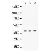 POLB / DNA Polymerase Beta Antibody - POLB antibody Western blot. All lanes: Anti POLB at 0.5 ug/ml. Lane 1: HELA Whole Cell Lysate at 40 ug. Lane 2: JURKAT Whole Cell Lysate at 40 ug. Lane 3: SMMC Whole Cell Lysate at 40 ug. Predicted band size: 39 kD. Observed band size: 39 kD.