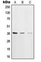POLB / DNA Polymerase Beta Antibody - Western blot analysis of DNA Polymerase beta expression in HeLa (A); NIH3T3 (B); rat brain (C) whole cell lysates.