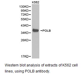 POLB / DNA Polymerase Beta Antibody - Western blot.
