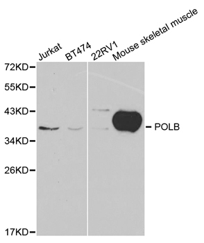 POLB / DNA Polymerase Beta Antibody - Western blot analysis of extracts of various cell lines, using POLB antibody at 1:1000 dilution. The secondary antibody used was an HRP Goat Anti-Rabbit IgG (H+L) at 1:10000 dilution. Lysates were loaded 25ug per lane and 3% nonfat dry milk in TBST was used for blocking.