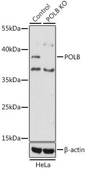 POLB / DNA Polymerase Beta Antibody - Western blot analysis of extracts from normal (control) and POLB knockout (KO) HeLa cells, using POLB antibodyat 1:1000 dilution. The secondary antibody used was an HRP Goat Anti-Rabbit IgG (H+L) at 1:10000 dilution. Lysates were loaded 25ug per lane and 3% nonfat dry milk in TBST was used for blocking. An ECL Kit was used for detection and the exposure time was 30s.