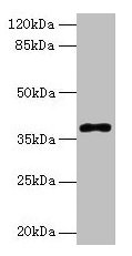 POLB / DNA Polymerase Beta Antibody - Western blot All lanes: POLB antibody at 8µg/ml + Colo320 whole cell lysate Secondary Goat polyclonal to rabbit IgG at 1/10000 dilution Predicted band size: 38 kDa Observed band size: 38 kDa