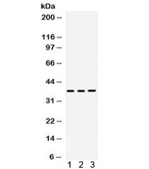 POLB / DNA Polymerase Beta Antibody