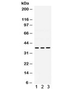 POLB / DNA Polymerase Beta Antibody
