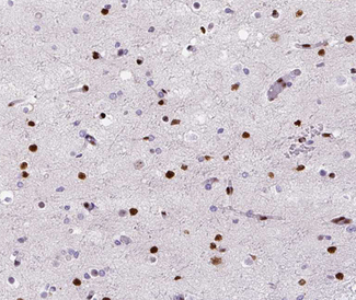 POLB / DNA Polymerase Beta Antibody - 1:200 staining human brain tissue by IHC-P. The tissue was formaldehyde fixed and a heat mediated antigen retrieval step in citrate buffer was performed. The tissue was then blocked and incubated with the antibody for 1.5 hours at 22°C. An HRP conjugated goat anti-rabbit antibody was used as the secondary.